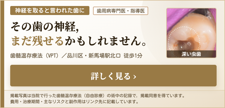 神経を残す歯髄温存療法（VPT）のご案内はこちら