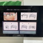 第38回院内実習