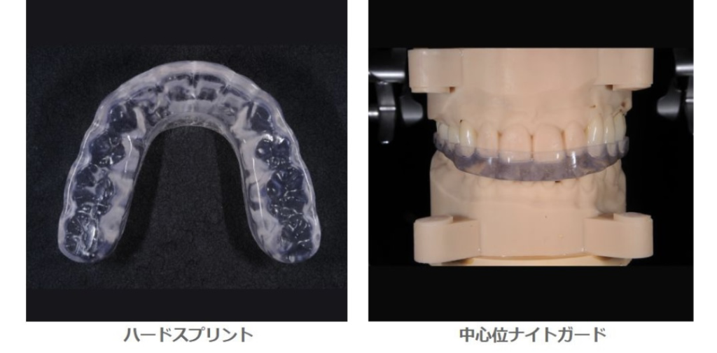 北品川　歯医者　ボトックス