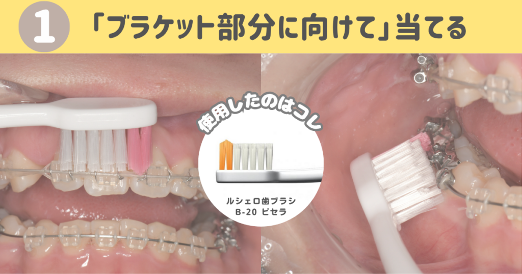 北品川　歯医者　矯正