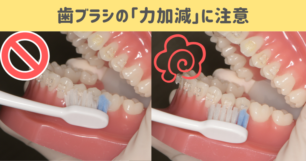 北品川　歯医者　矯正