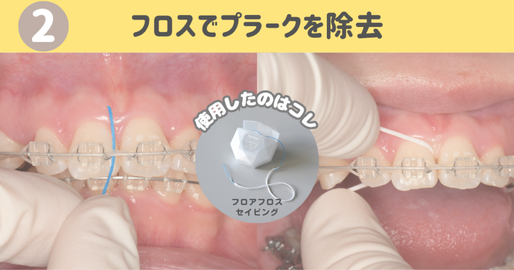 北品川　歯医者　矯正