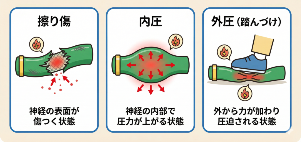 根管治療後の痛みの説明