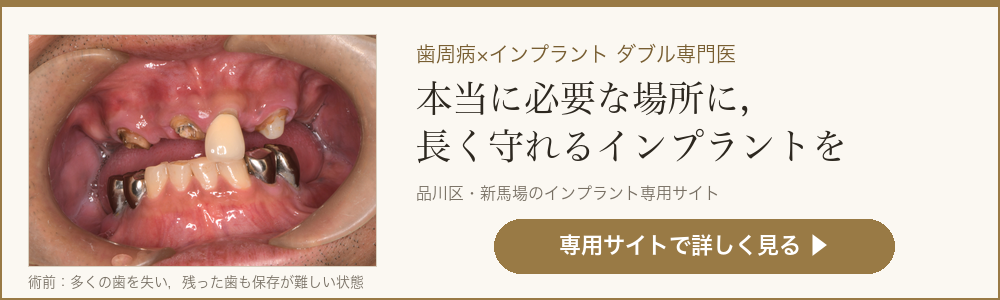 インプラント治療